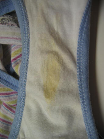 vaginal discharge in panties Drilled metal strips
